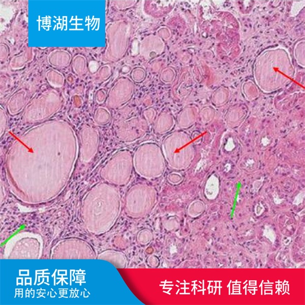 OCI-M1人急性髓白血病细胞