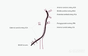 mcao线栓