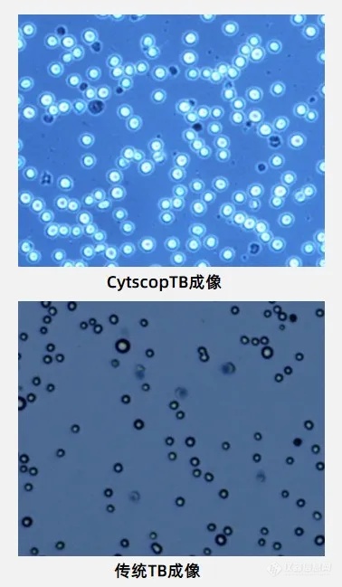 浚真专利光学技术赋能高精准细胞计数