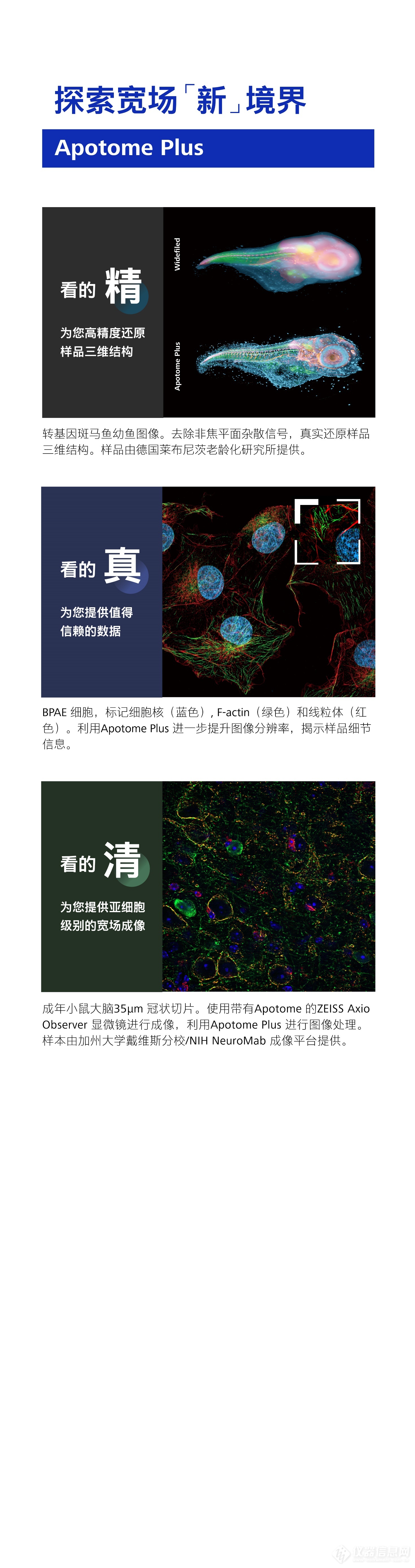 网络研讨会 | 探索蔡司宽场光切“新“境界