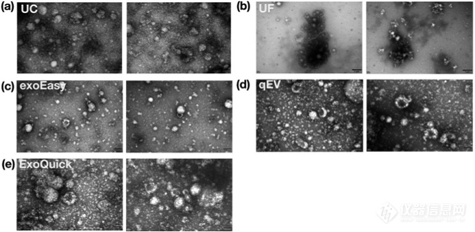 【应用文章】NanoCoulter评测五种细胞外囊泡分离方法：效率与纯度大比拼