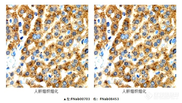 免疫组化抗体实验结果