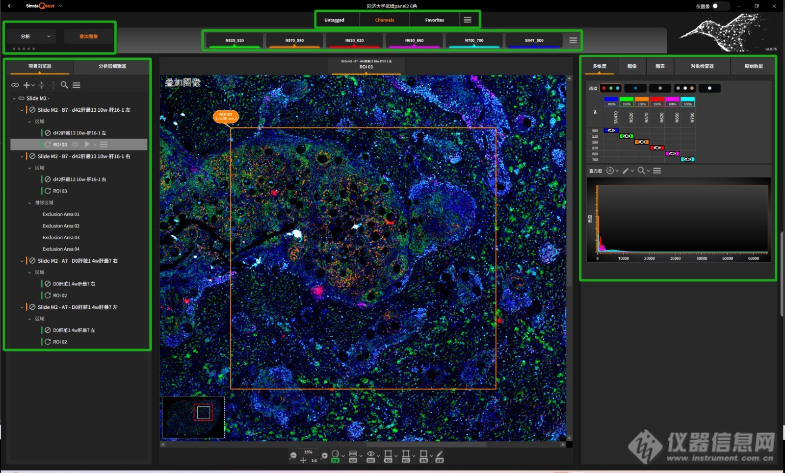 TissueGnostics组织细胞定量分析系统StrataQuest 8.0版本_报价 - TissueGnostics