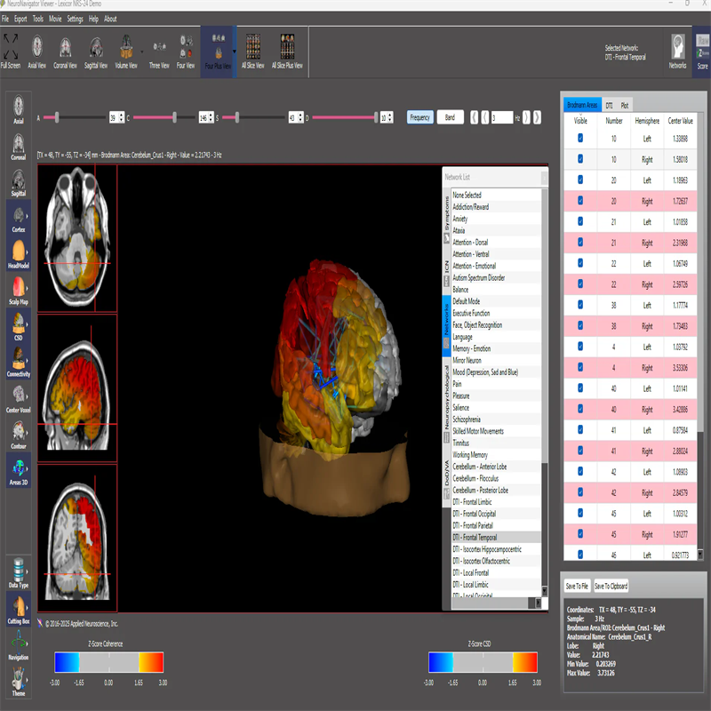 BrainBit NeuroGuide专业的定量脑电（qEEG）套件_参数_价格-仪器信息网