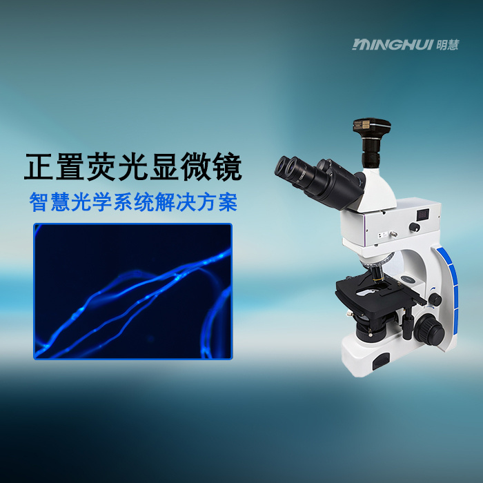 明慧 真菌荧光检测系统UB203i-FL