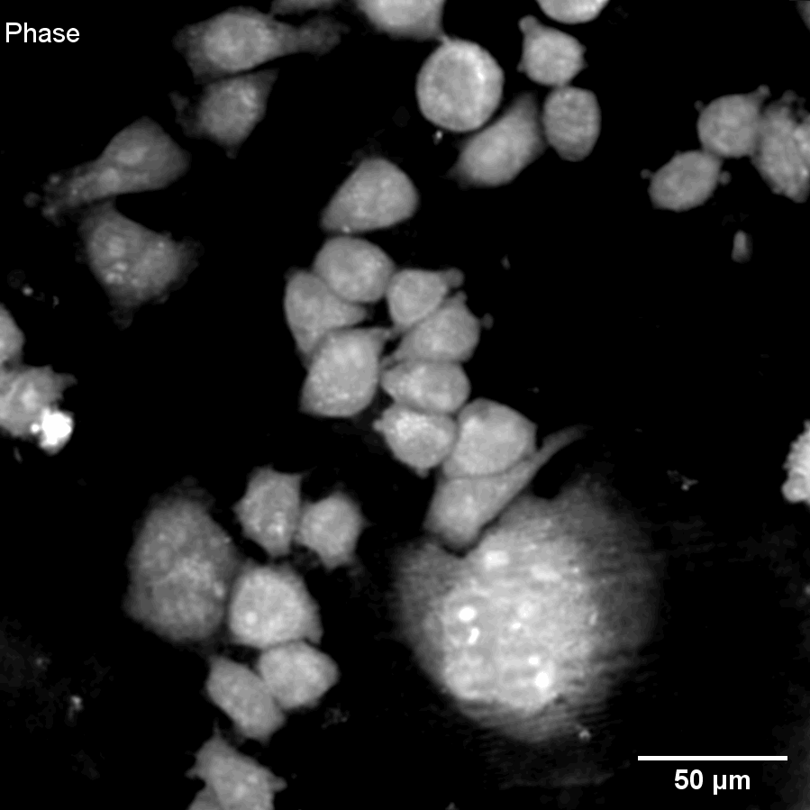 Combined-Phase-and-Fluo_HeLa-RG-1.gif