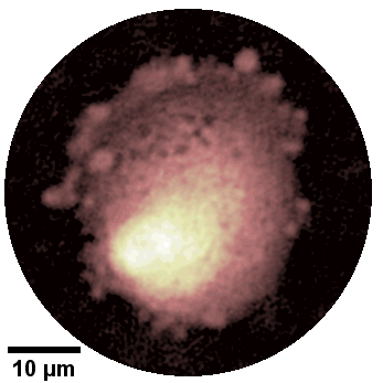 Human_fibroblasts_DHM_biological_phase_imaging.gif