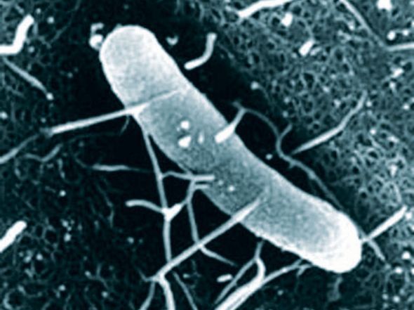 发现“超级细菌” 