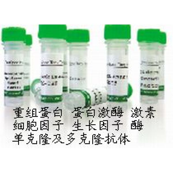 Mouse Anti  Dengue Type 2 (envelop)