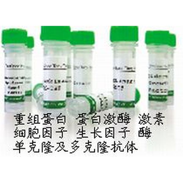 Polyclonal Rabbit Anti Human Gamma-Synuclein （SNCG）