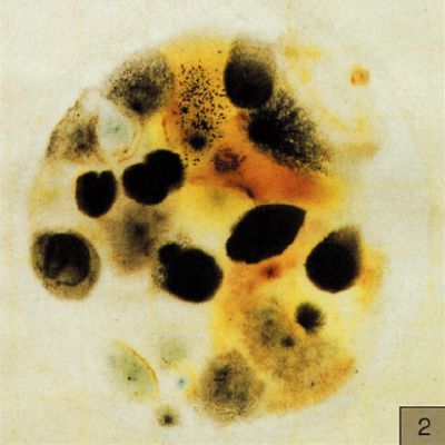 霉菌和酵母菌测试片（美国3M）