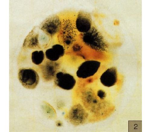 霉菌和酵母菌测试片（美国3M）