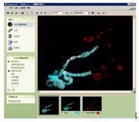 VideoTesT-FISH荧光原位杂交分析系统