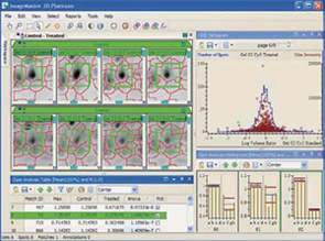ImageMaster 2D Platinum 分析软件