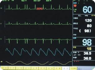 病人监护仪（六参数）